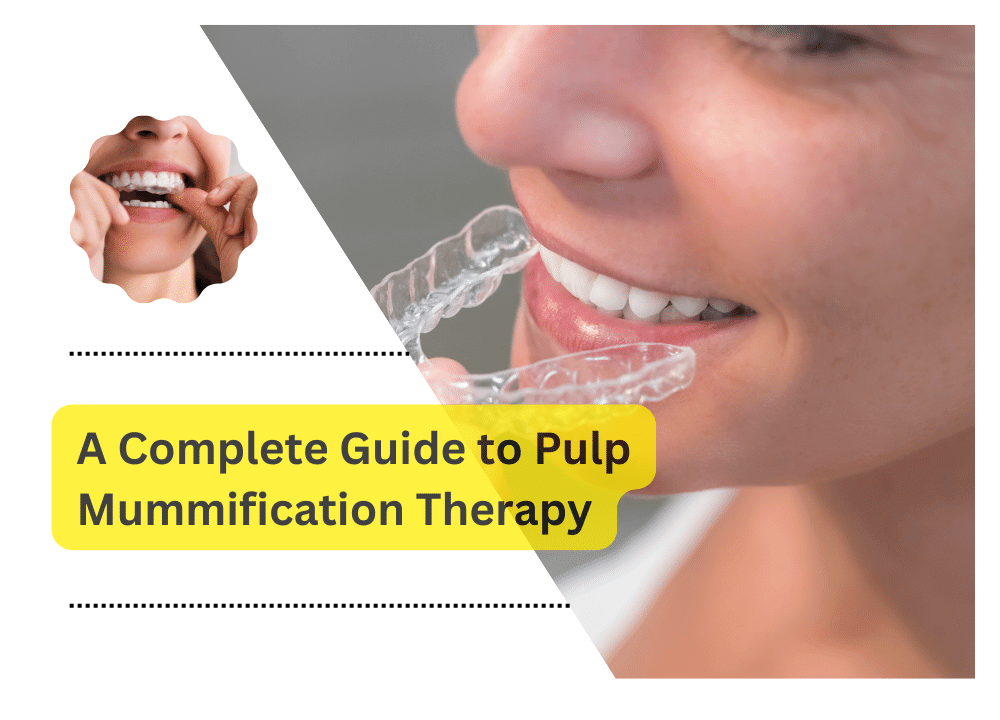 A Complete Guide to Pulp Mummification Therapy
