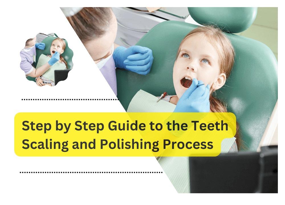 Step-By-Step Guide To The Teeth Scaling And Polishing Process
