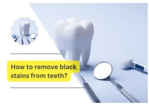 How to remove black stains from teeth?