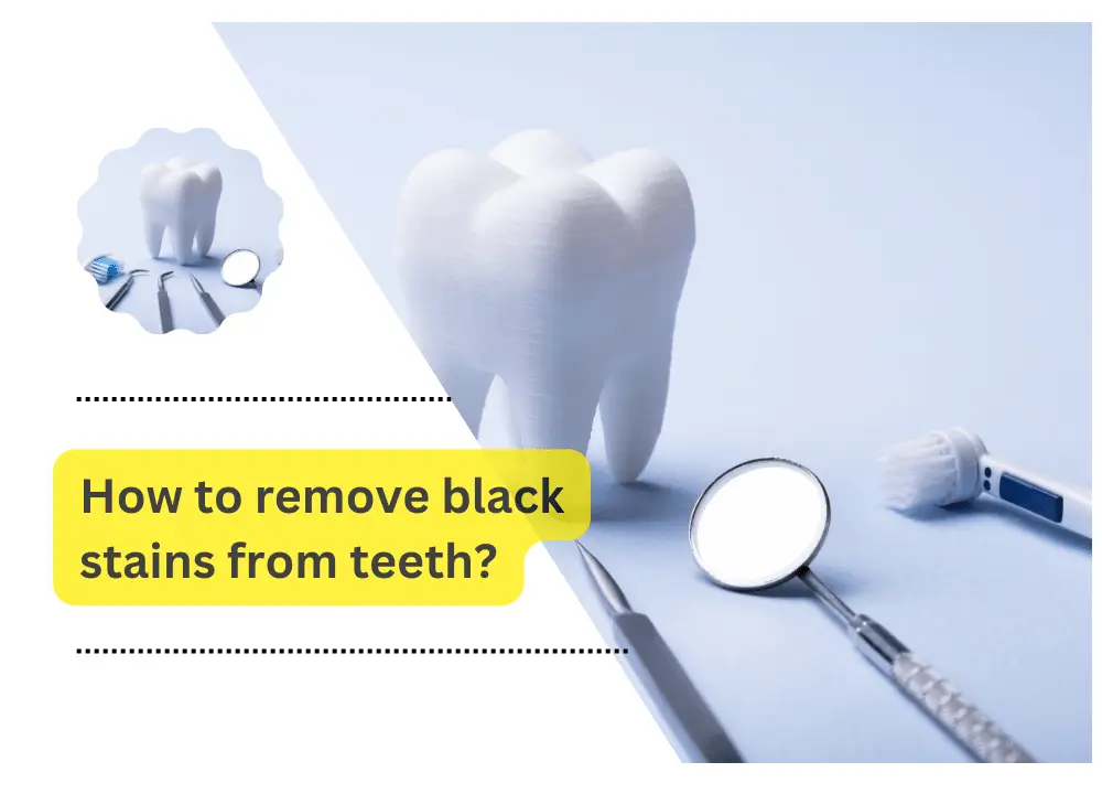 remove black stains from teeth