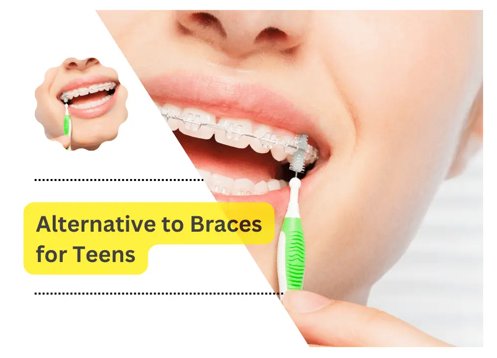 Alternative to Braces for Teens