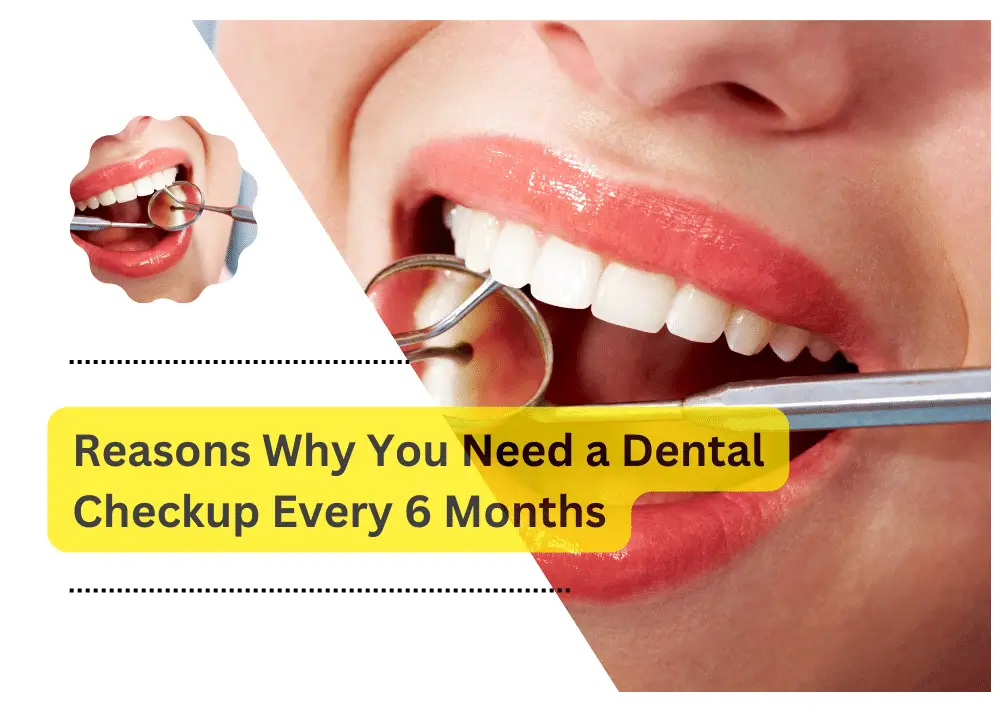 Dental Checkup Every 6 Months