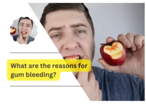 What are the reasons for gum bleeding?