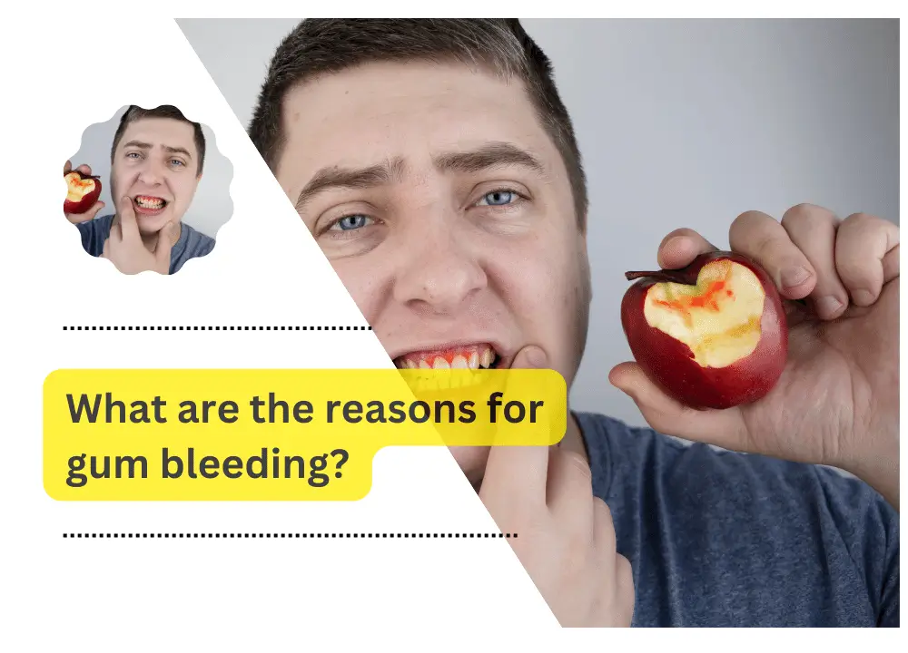 gum bleeding