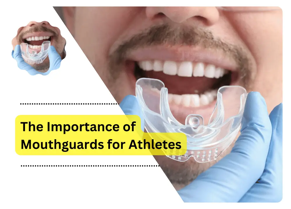 The Importance of Mouthguards for Athletes