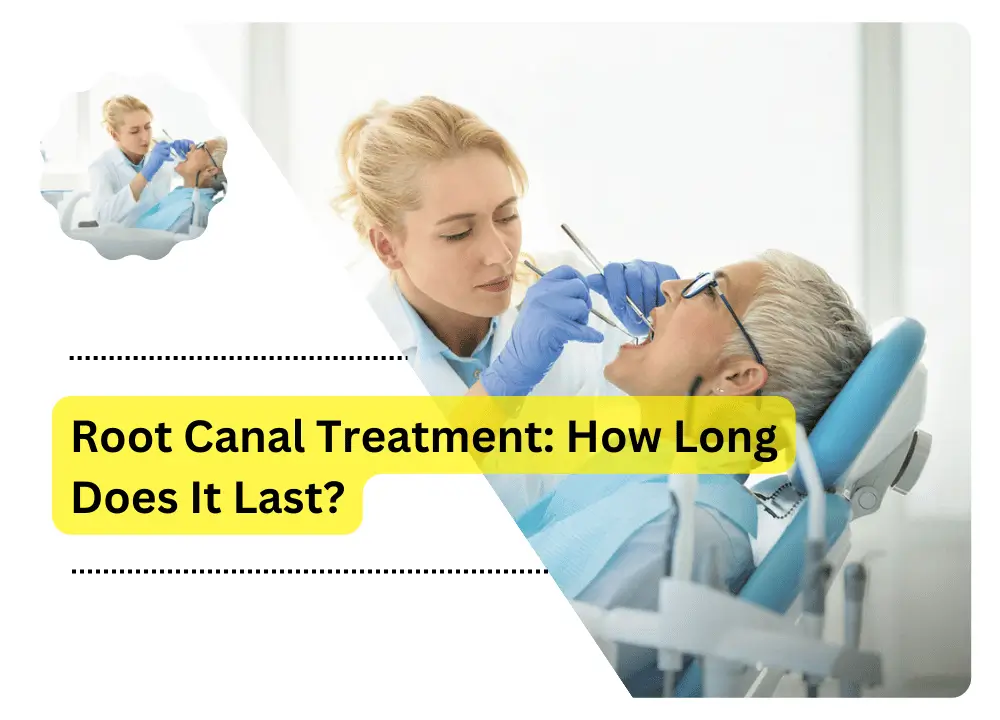 Root Canal Treatment: How Long Does It Last?