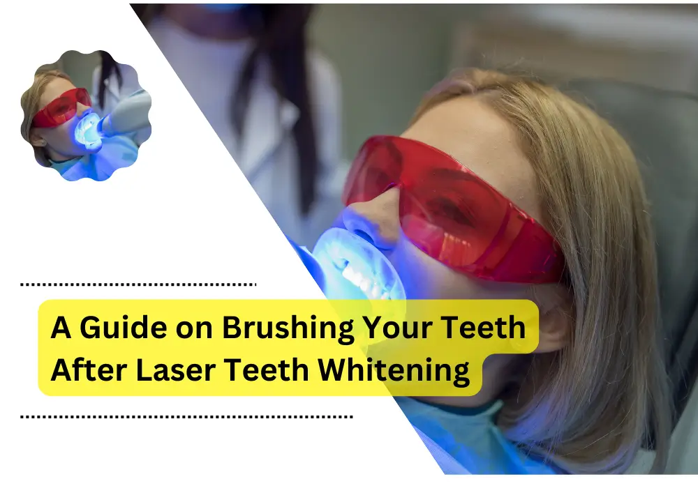 laser teeth whitening