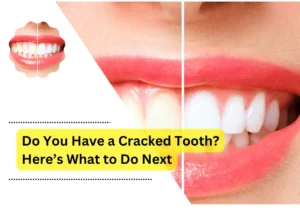 Do You Have a Cracked Tooth? Here’s What to Do Next