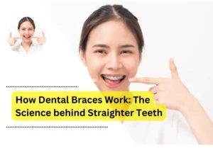 How Dental Braces Work: The Science behind Straighter Teeth