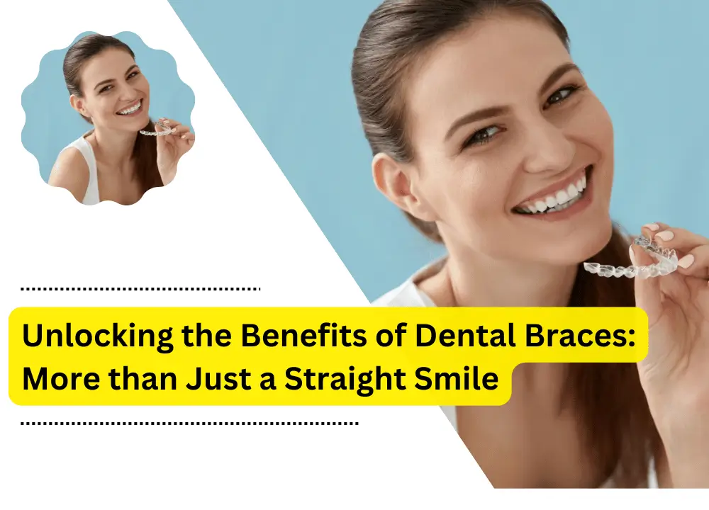 Dental Braces