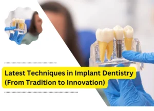 Latest Techniques in Implant Dentistry (From Tradition to Innovation)