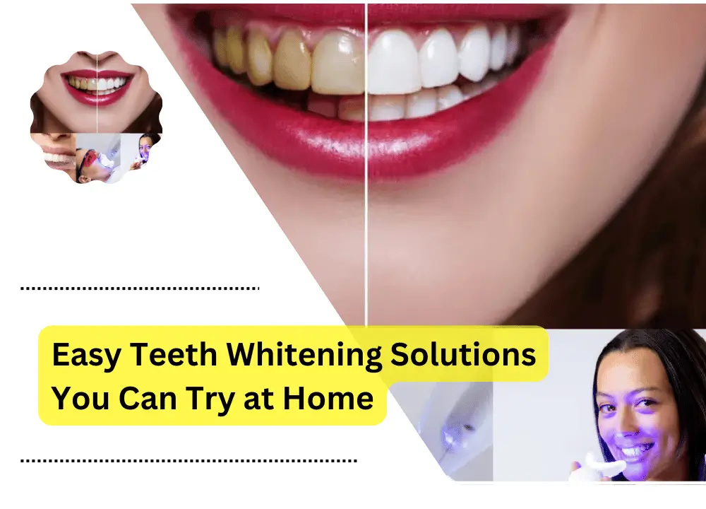 teeth-whitening solutions