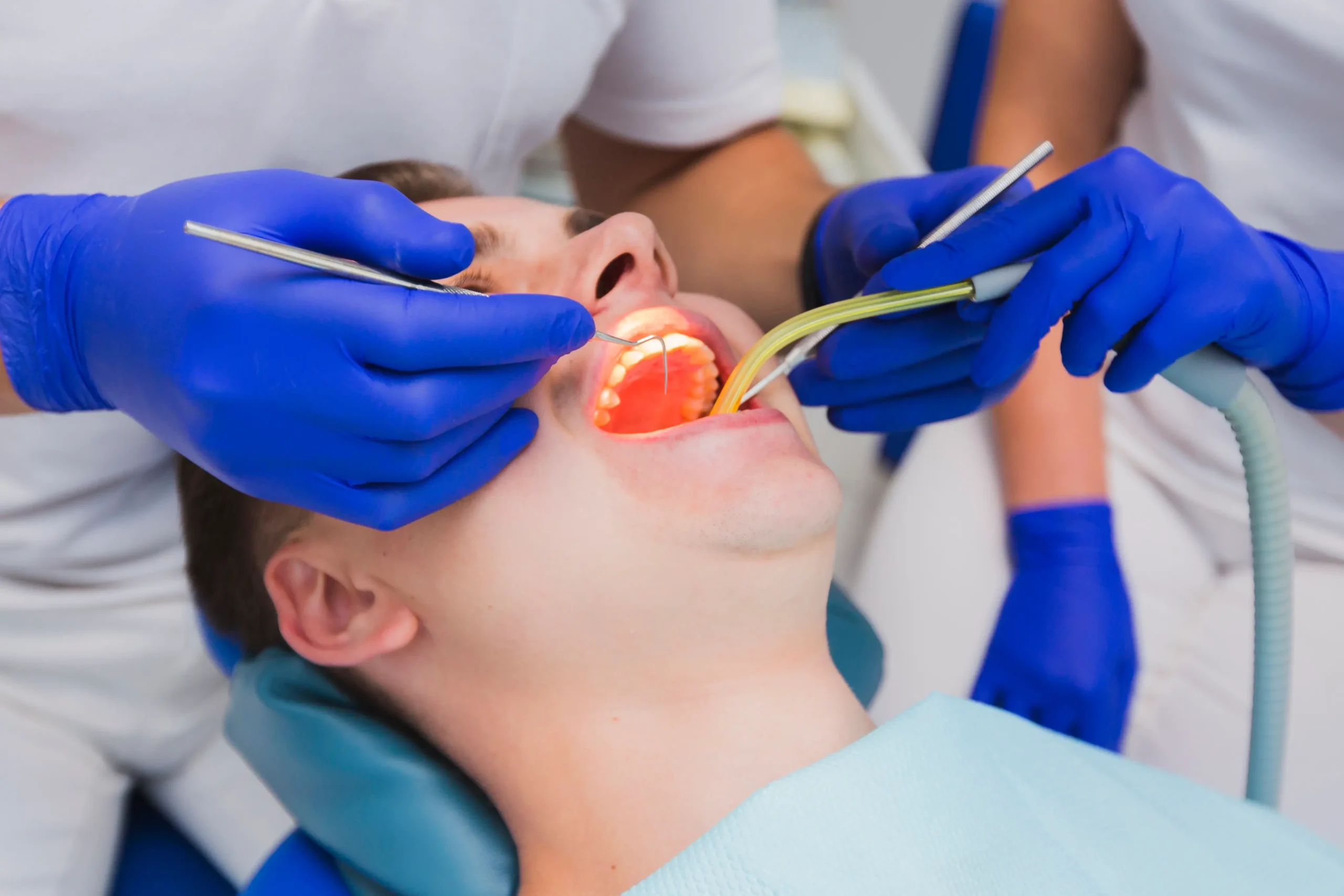 Dental Filling Treatment at Hassaan Dental